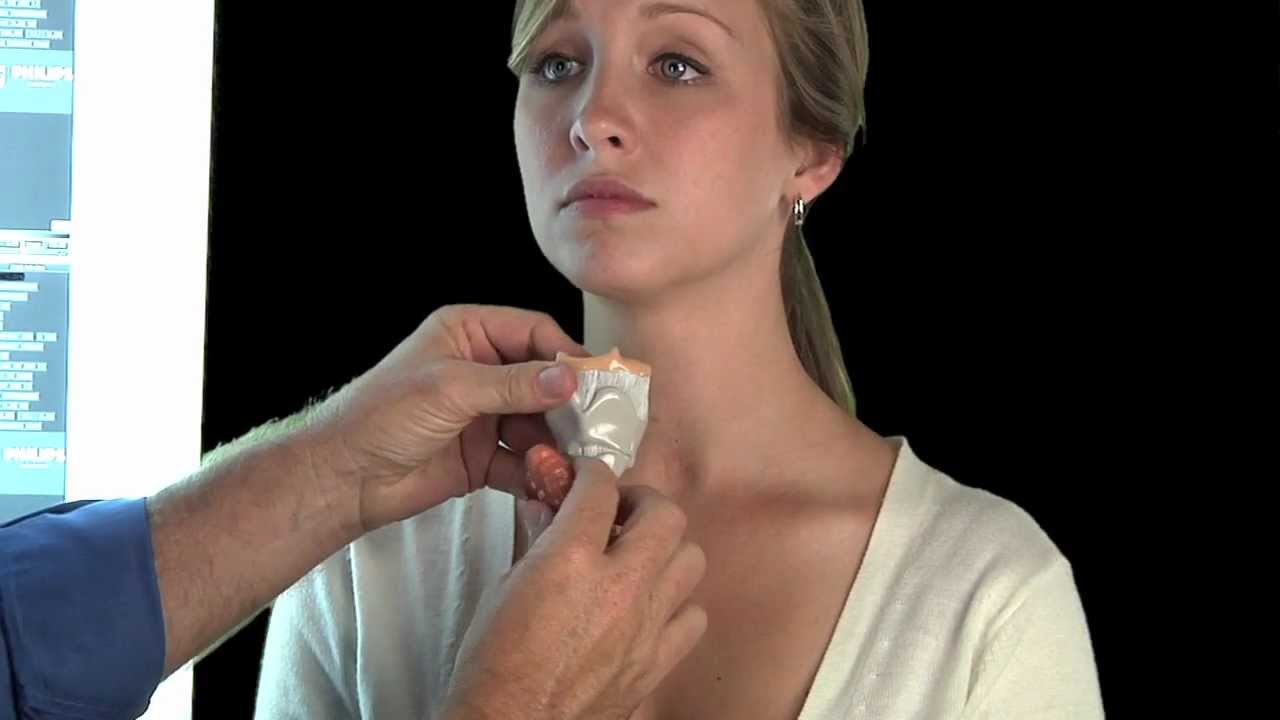 Where Are Parathyroid Glands and Why is Parathyroid Surgery So Tricky?