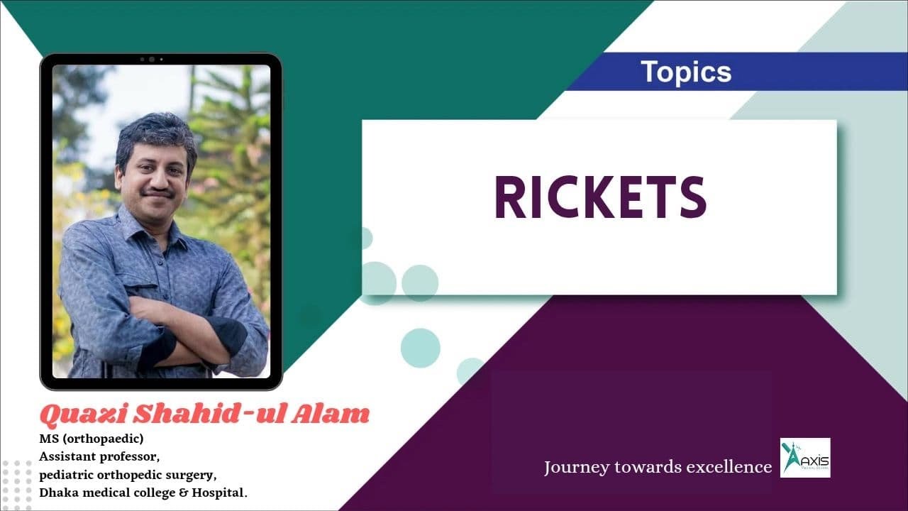 Rickets
