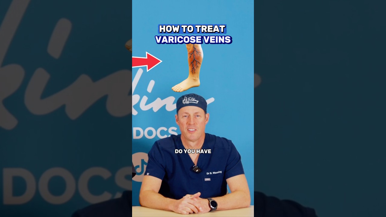 Varicose Veins Treatment Explained