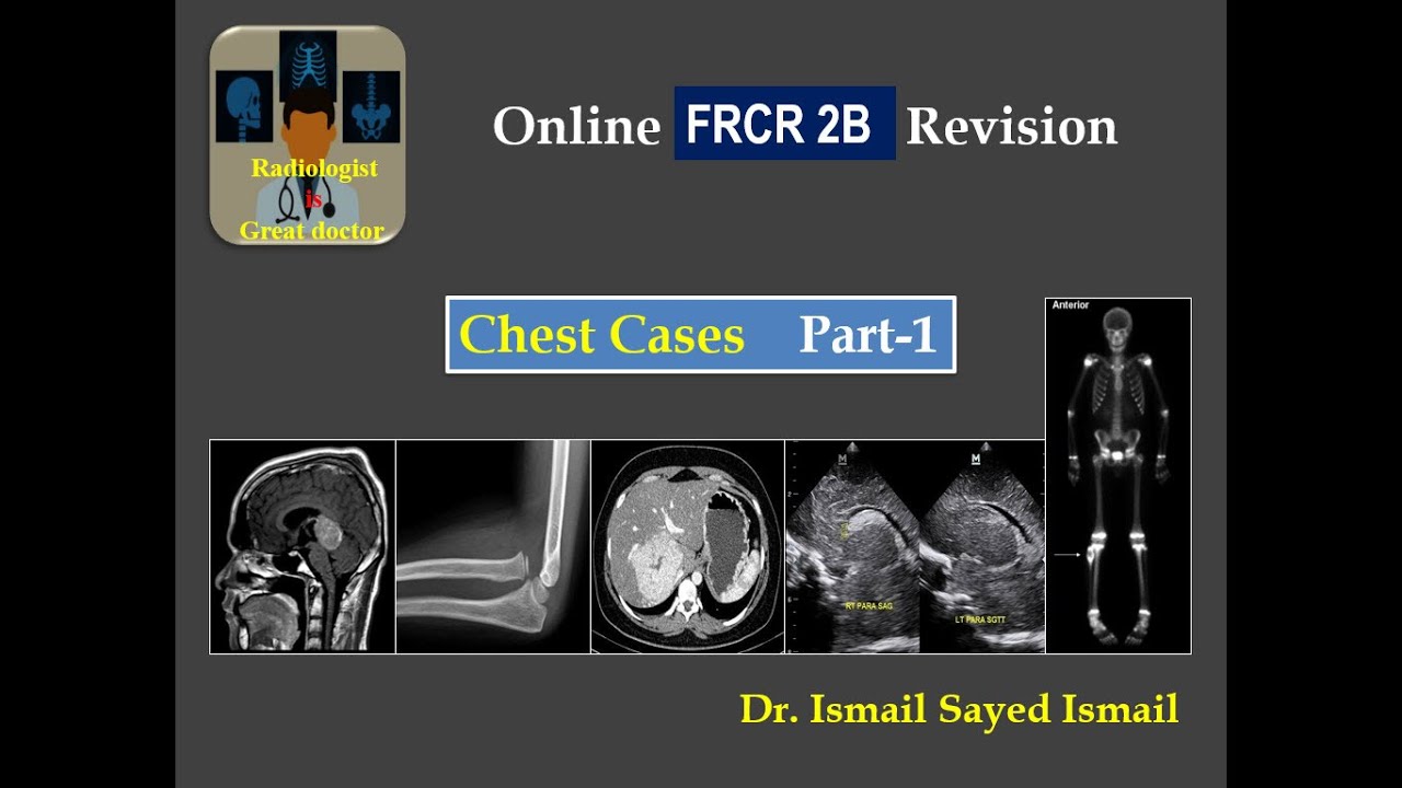 Chest Revision for FRCR 2B - Part 1