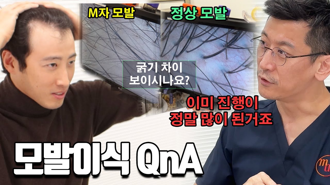 모발이식에 대해 모든 것을 묻고 왔습니다. 여러분은 늦지말고 결정 빨리하세요...