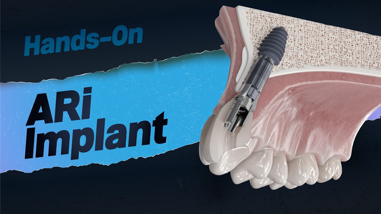 ARi Hands-On
