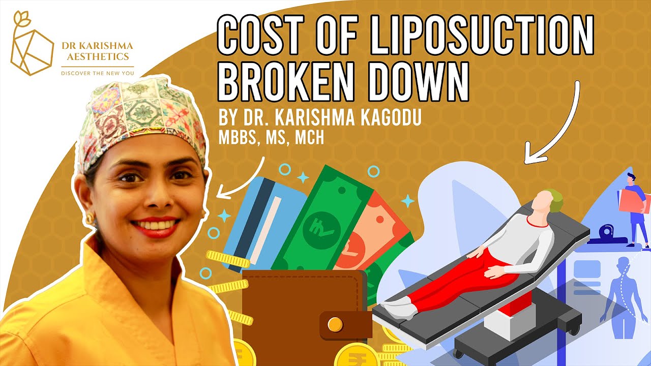 Cost of Liposuction || Dr. Karishma Kagodu || Dr. Karishma Aesthetics, Bengaluru, India.