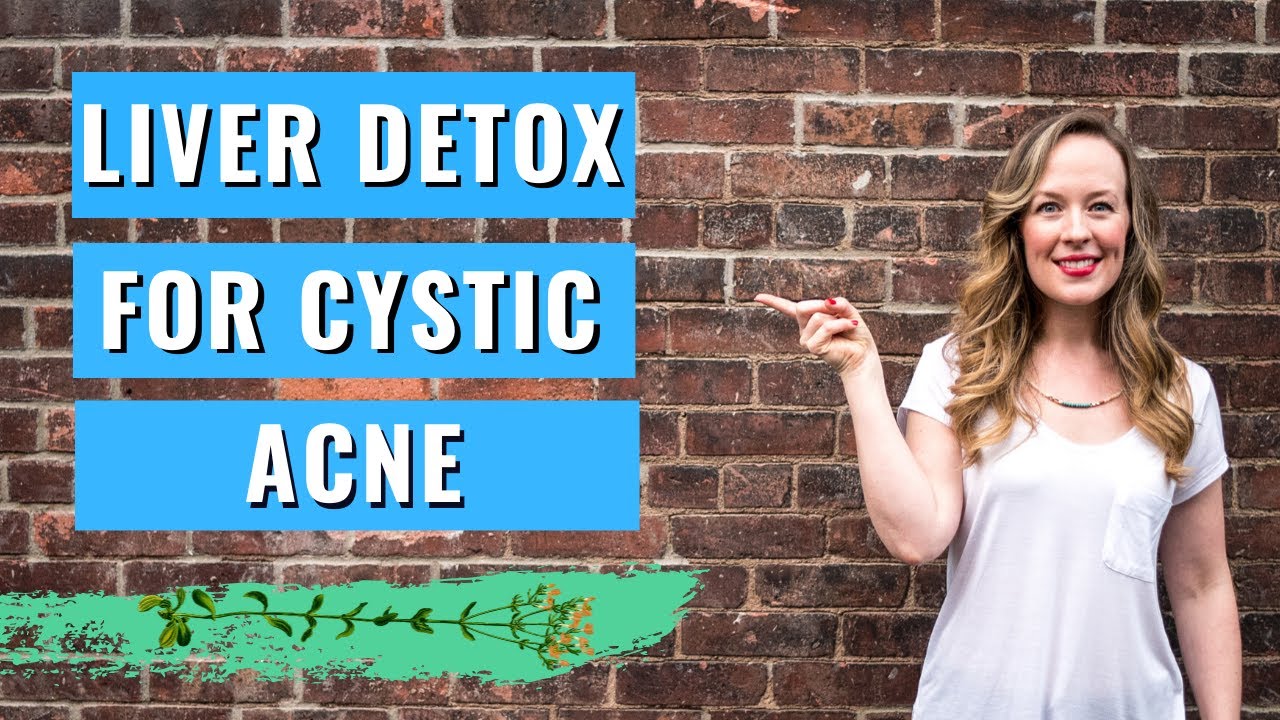 Liver detox for acne - LIVER CONGESTION GIVING YOU CYSTIC ACNE?