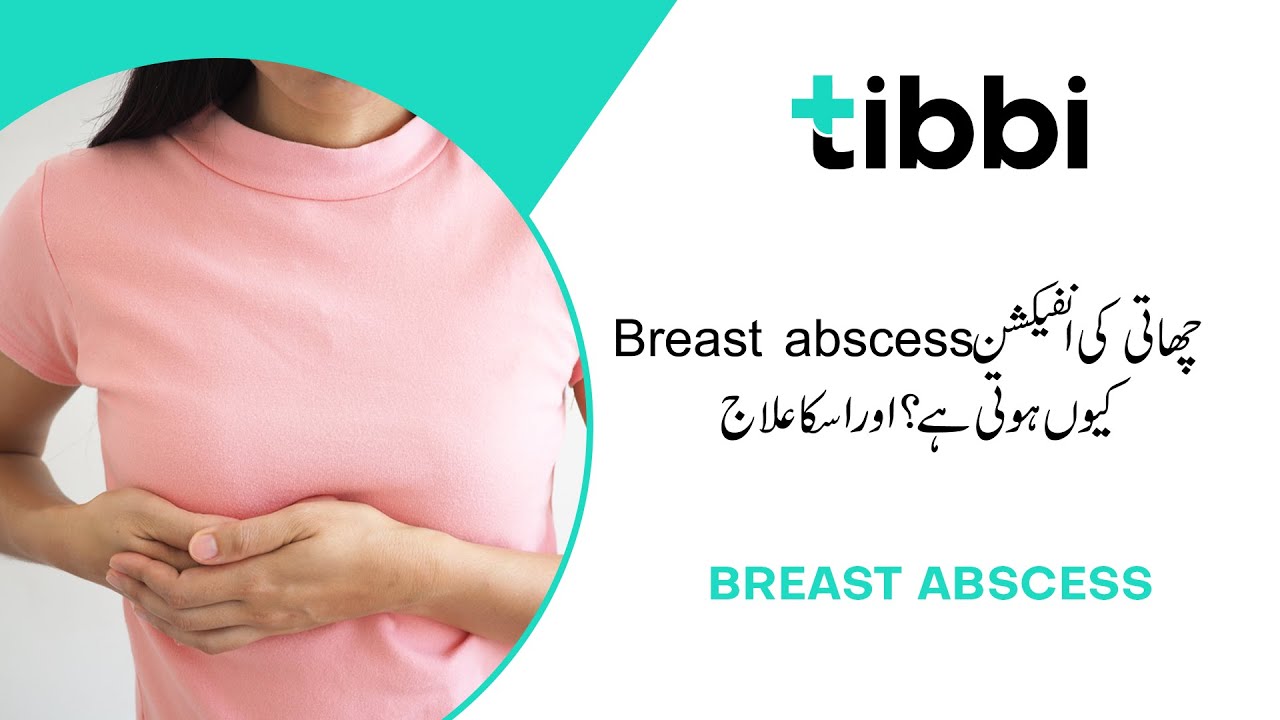 Breast Infection and Breast Abscess &ndash; Breast ki infection aur iska ilaaj | tibbi