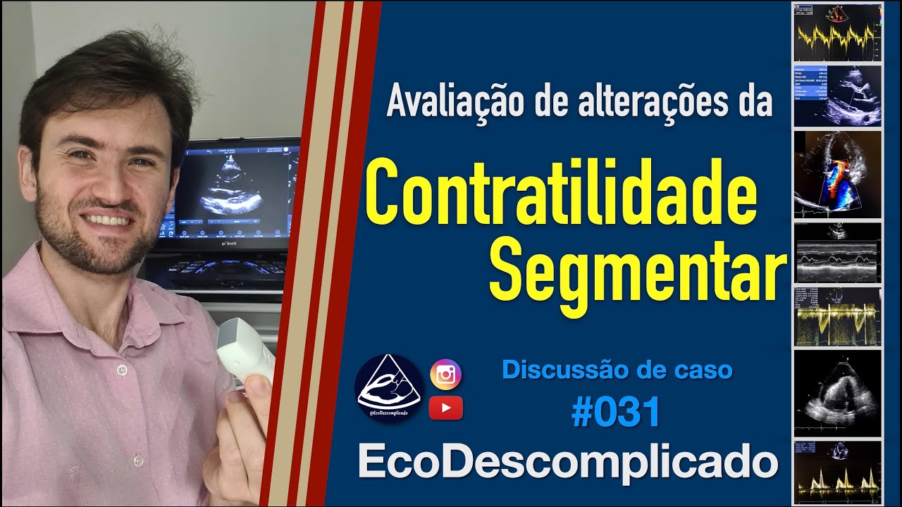 EcoDescomplicado - Discussão de caso AO VIVO #031 - Avaliando alterações da contratilidade segmentar