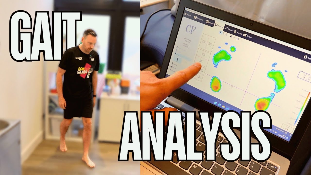 My gait analysis was shocking!!