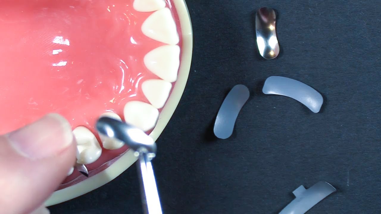 5 самых популярных вопросов: № 3 | Размещение матричной полосы