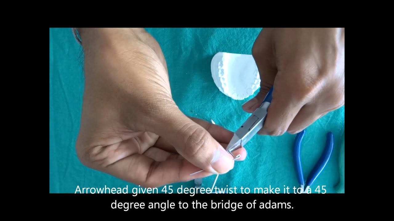 Fabrication of Adams clasp
