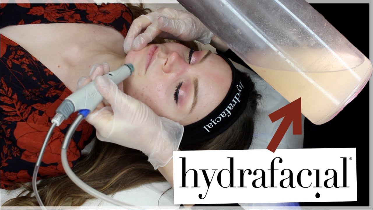HYDRAFACIAL ✨ AVANT / APRÈS
