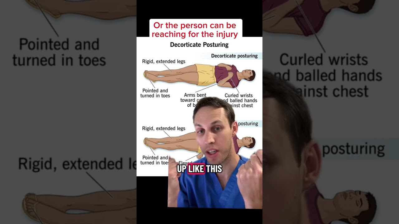 What the arms can tell you about penetrating neck trauma