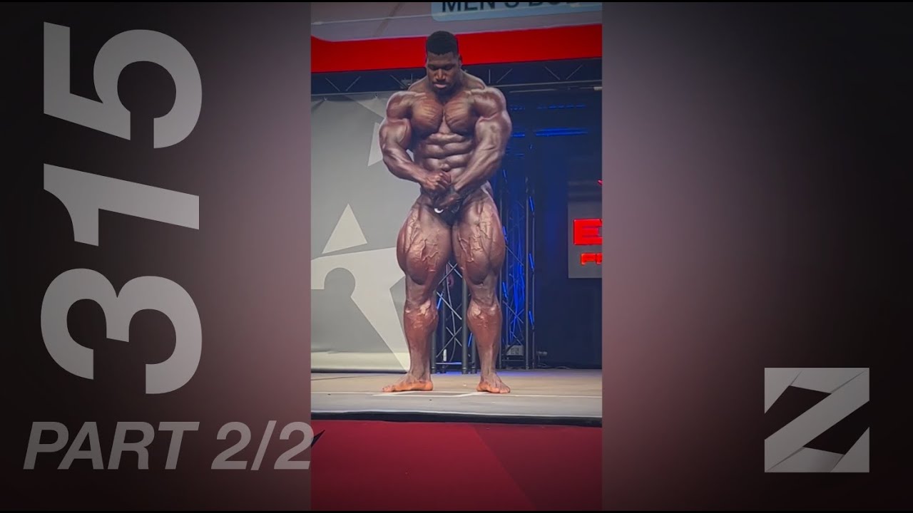 iZap4u – Zap 315 (Short Edit) Part 2/2