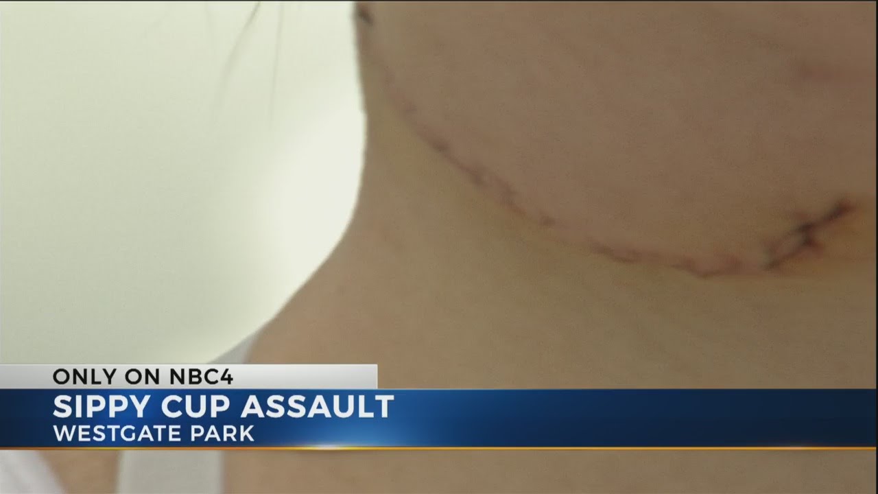 Mother's jaw broken in fight over broken sippy cup