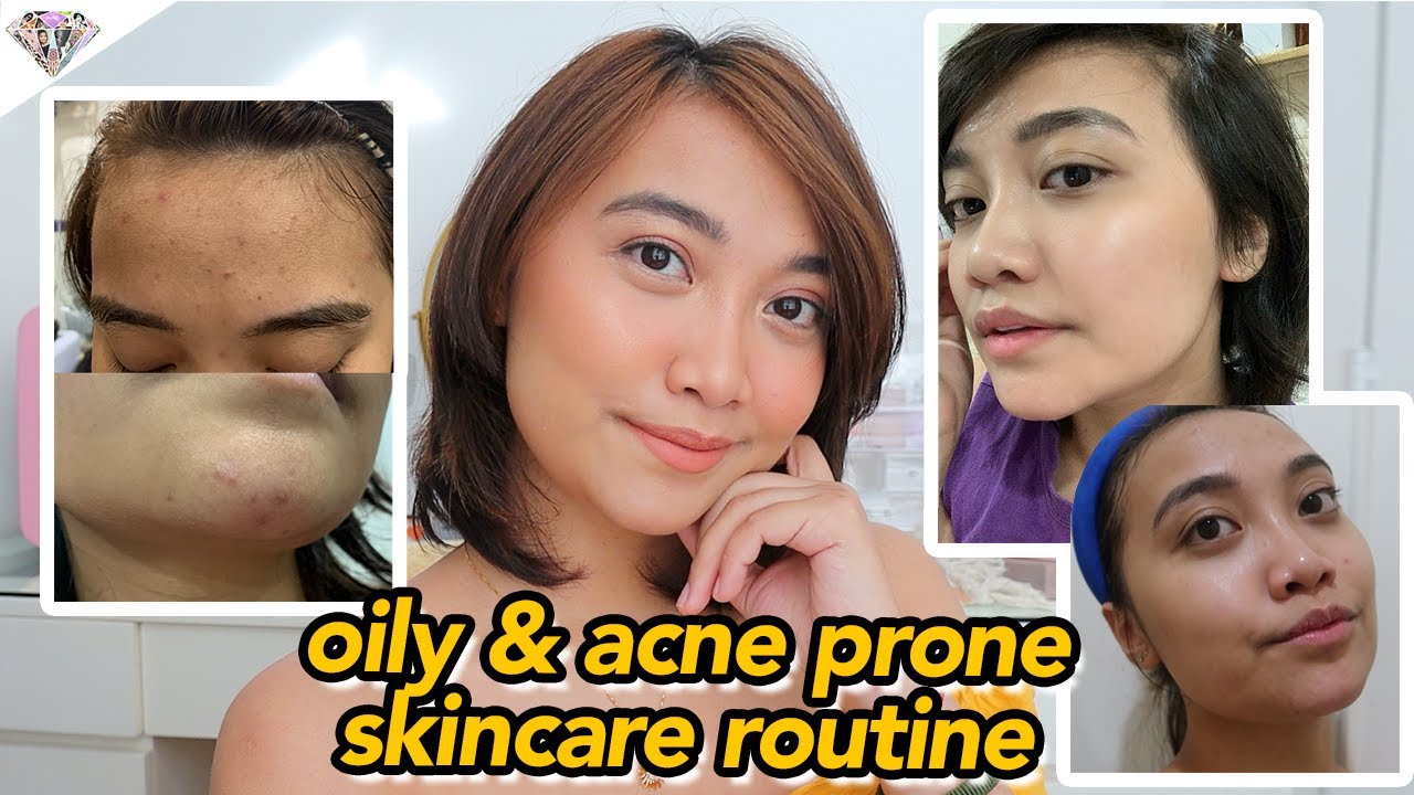 SKINCARE ROUTINE FOR OILY & ACNE PRONE SKIN 2020 | PAANO AKO KUMINIS? | MAE LAYUG