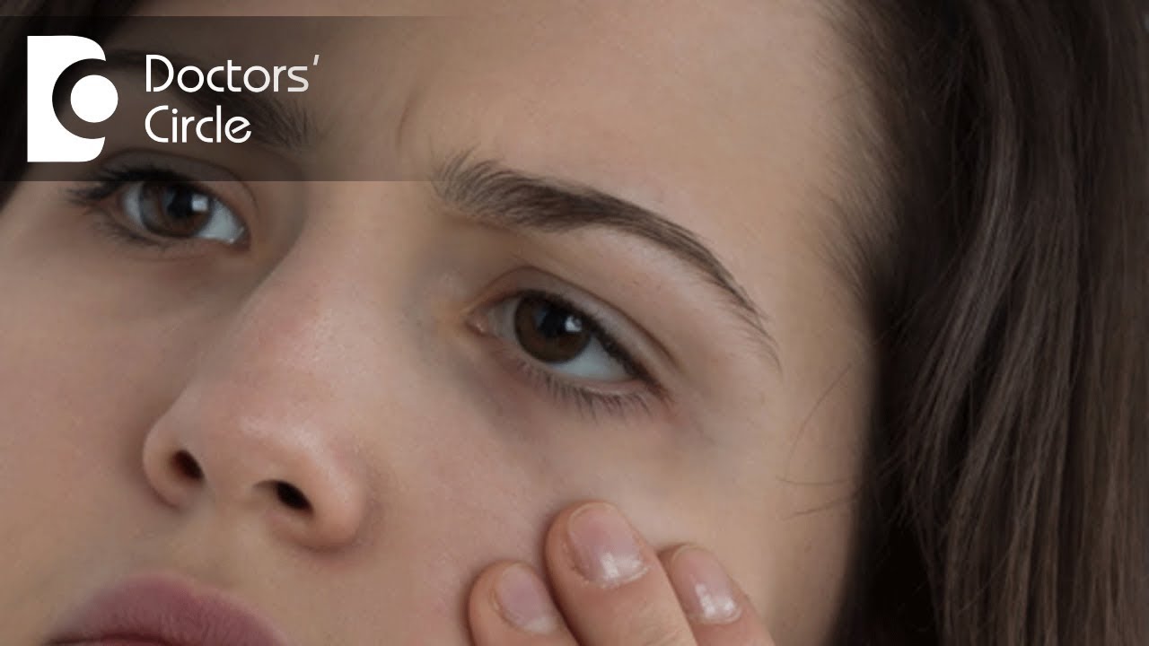 How to manage mixed black& white patches near eyes? - Dr. Aruna Prasad