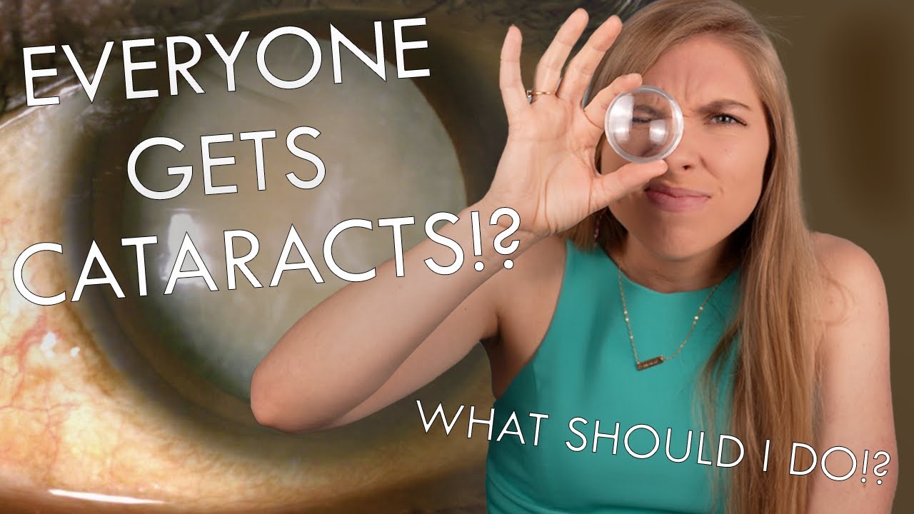 Do YOU Need Cataract Surgery? You Were Diagnosed With Cataracts--WHAT NOW?!?