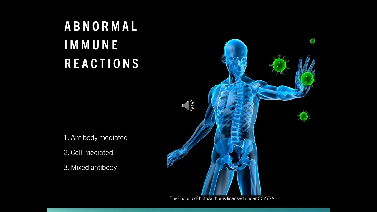 Immunity Presentation