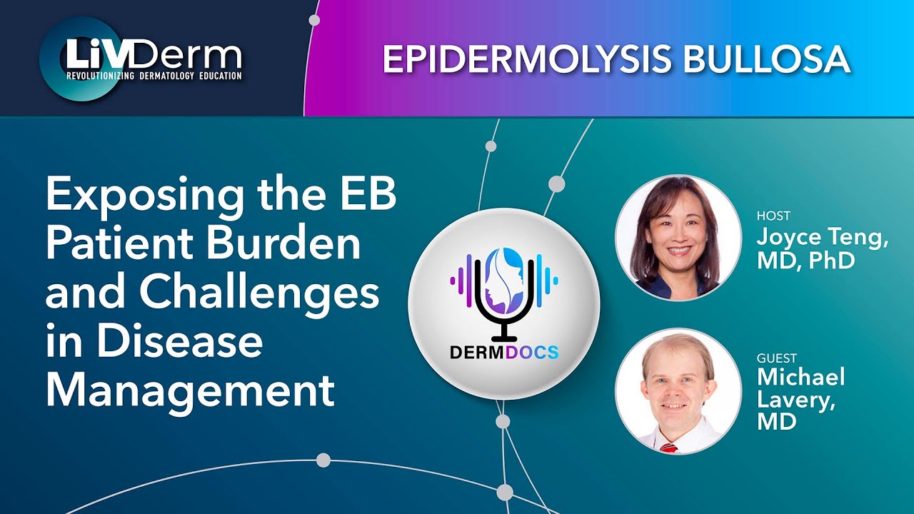 Exposing the Epidermolysis Bullosa Patient Burden and Challenges in Disease Management