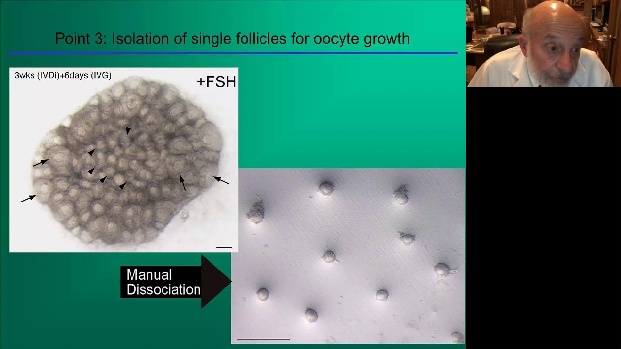 Dr. Silber: IVM and In Vitro Maturation Talk