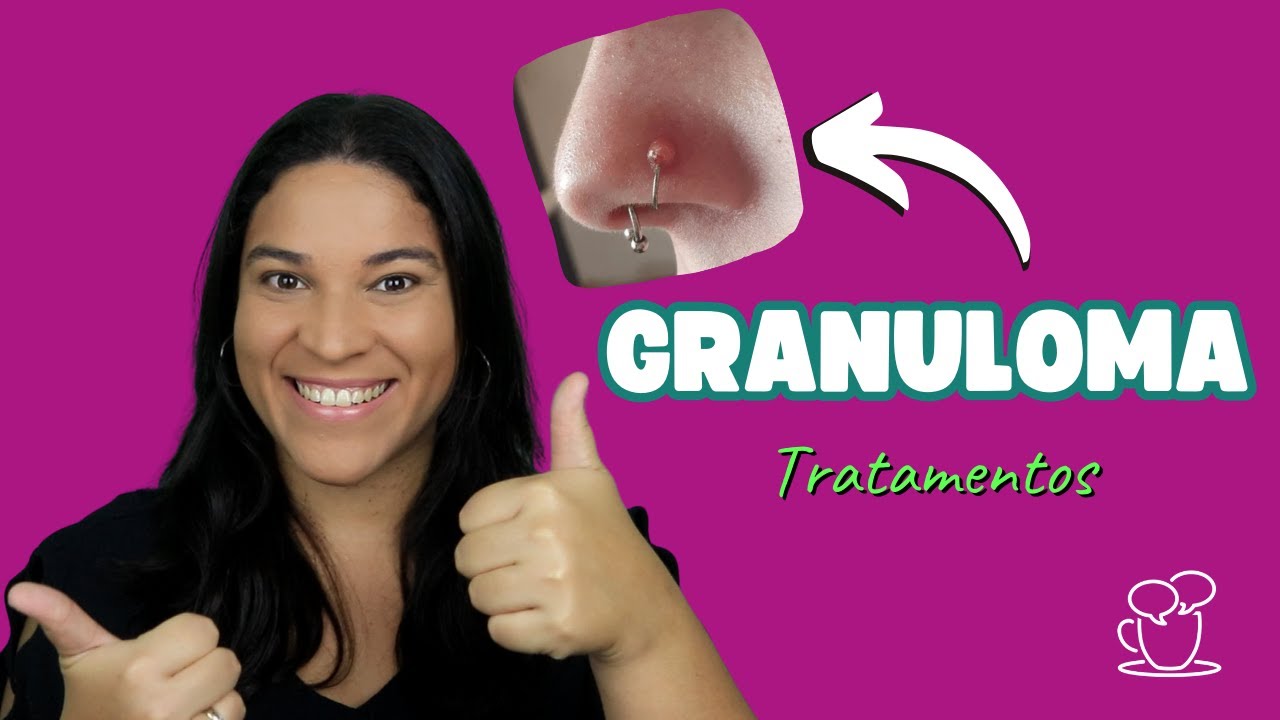 Granuloma PÓS PIERCING: o que é e como tratar?