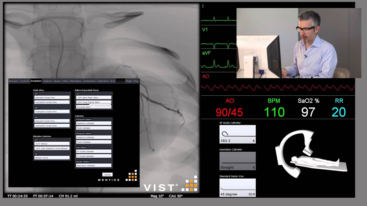 Primary PCI AMI 3 Alternative 1 - Mentice VIST C