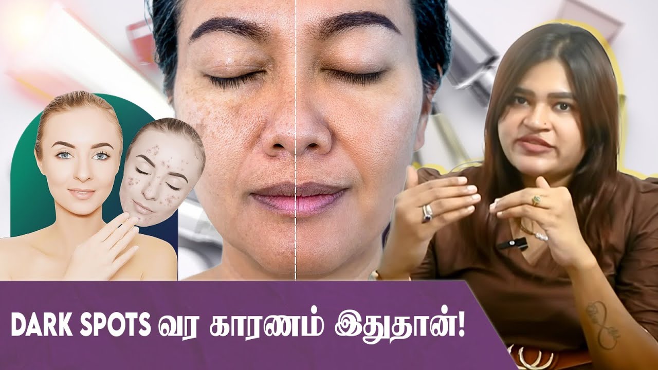 Pigmentation பிரச்சனையா? இந்த Serums Try பண்ணுங்க! | Dr Radha Explains