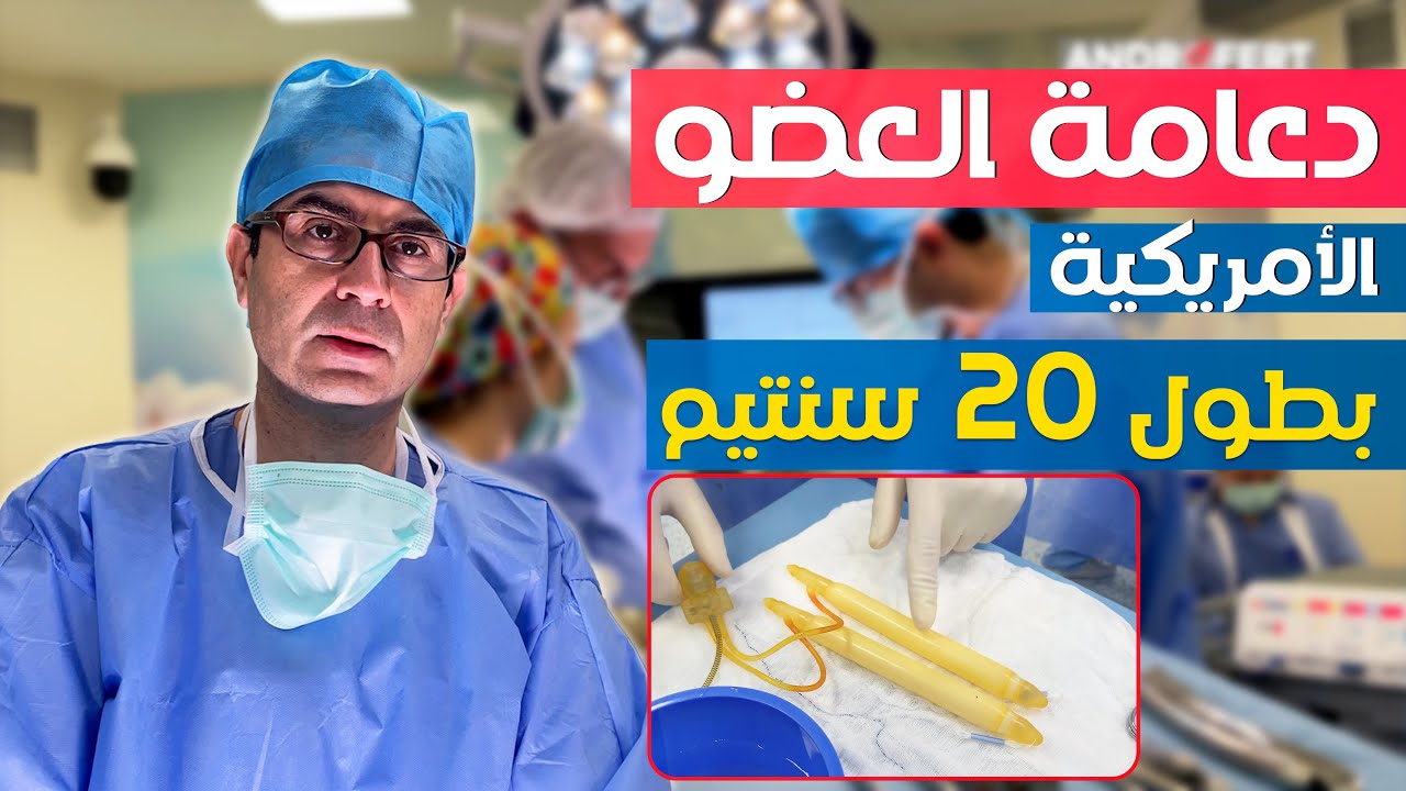 زرع دعامة العضو الهيدروليكية الأمريكية، بطول 20 سنتيم - AMS 700 LGX