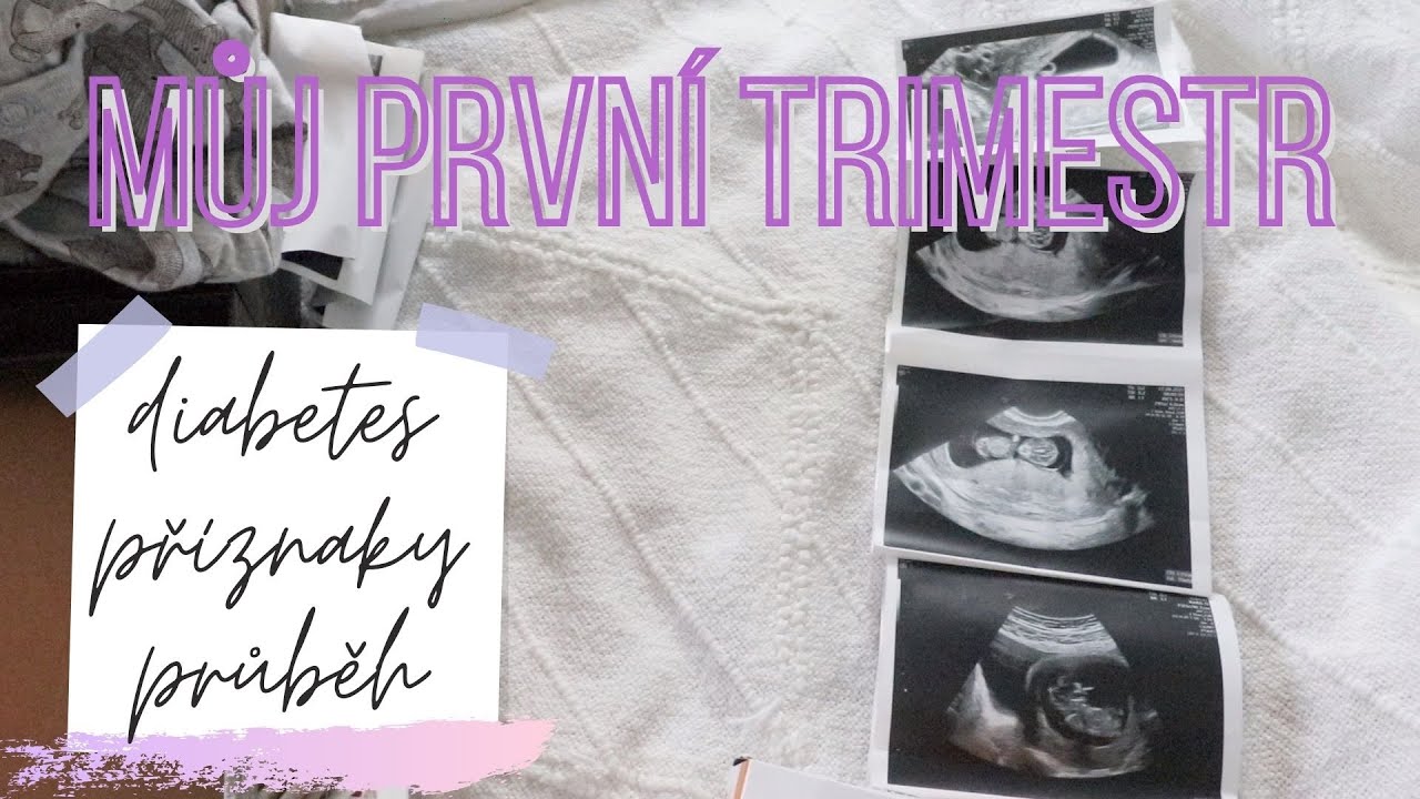 🤰🏼MŮJ PRVNÍ TRIMESTR | příznaky, těhotenská cukrovka, průběh a vyšetření běhěm prvního trimestru