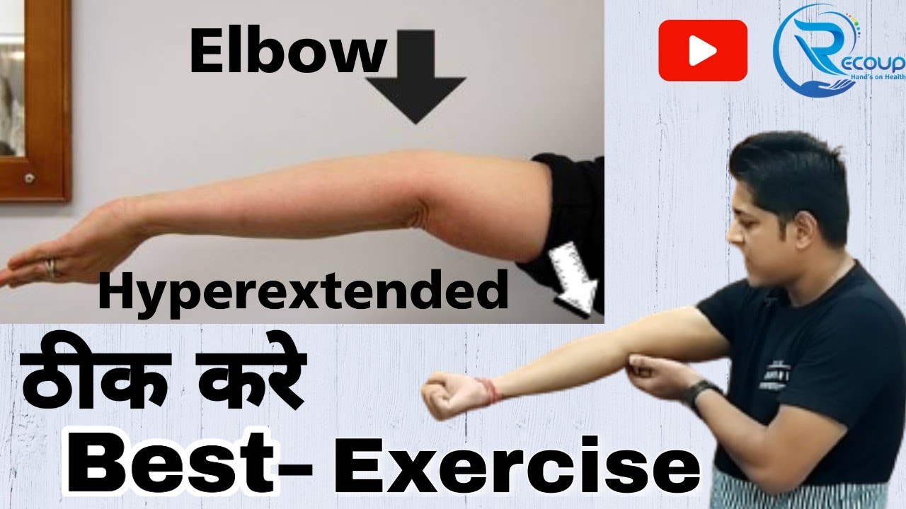hyperextended elbow treatment.kohni ka tirchapan kaise thik kare.elbow deformity. #elbows #elbowpain