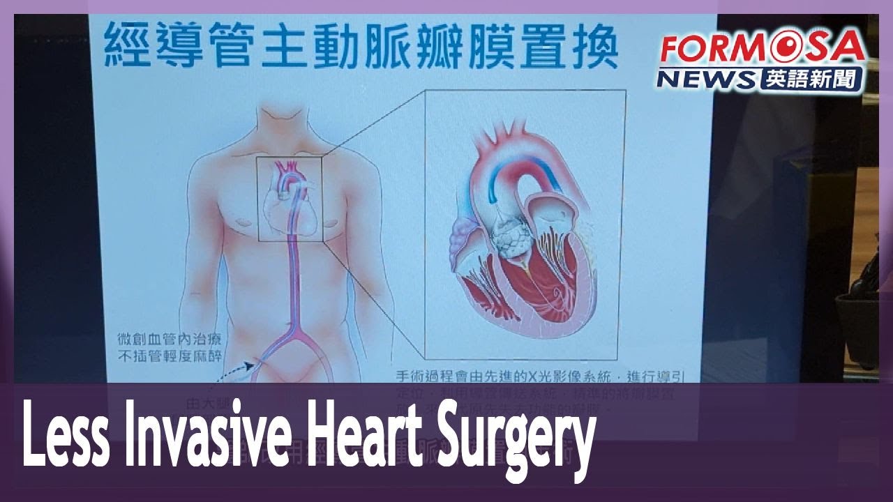 Transcatheter aortic valve replacement helps high-risk patients with heart disease