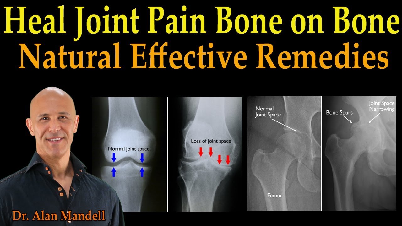 Heal Joint Pain Bone on Bone - Dr. Alan Mandell, D.C.
