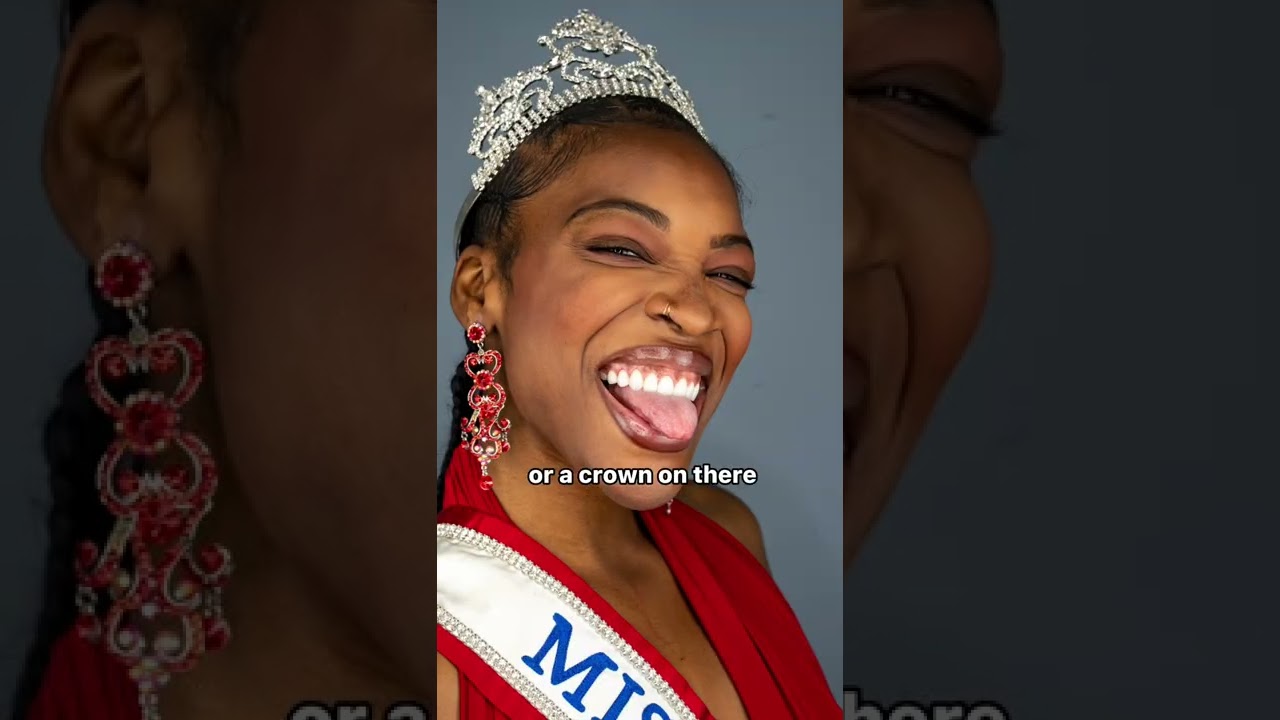 Veneers vs Crowns #shorts #crowns #dentalcare #teeth #veneers #cincinnati
