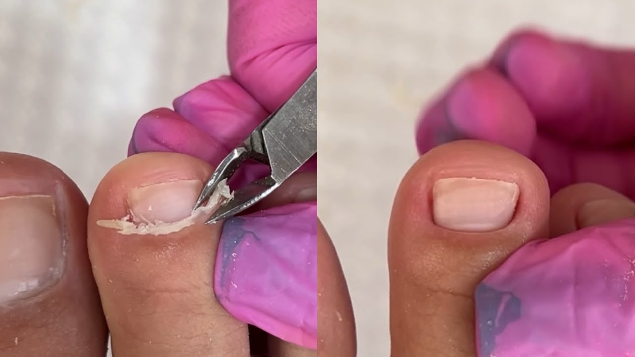 REMOVENDO CUTÍCULA DAS UNHAS DOS PÉS 🤤