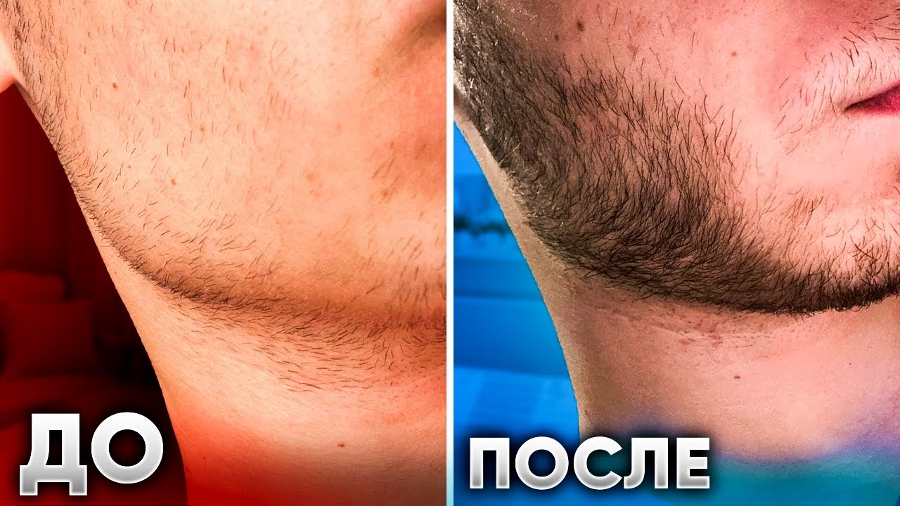 Что творит Mr.Volos! Результат всего за 2,5 месяца