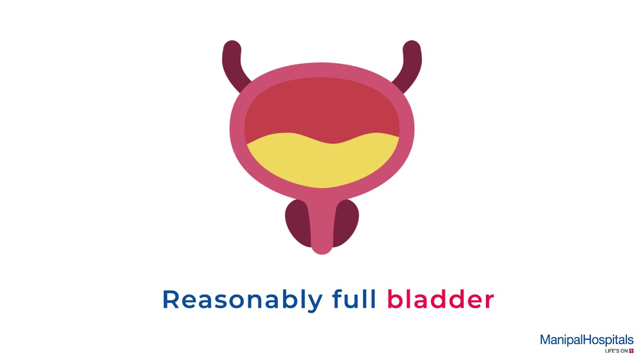 What is Uroflowmetry? | Manipal Hospitals India