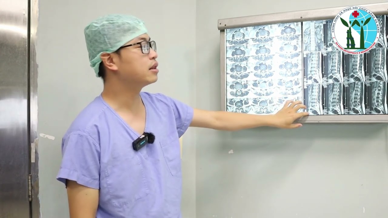 MỔ NỘI SOI THOÁT VỊ ĐĨA ĐỆM