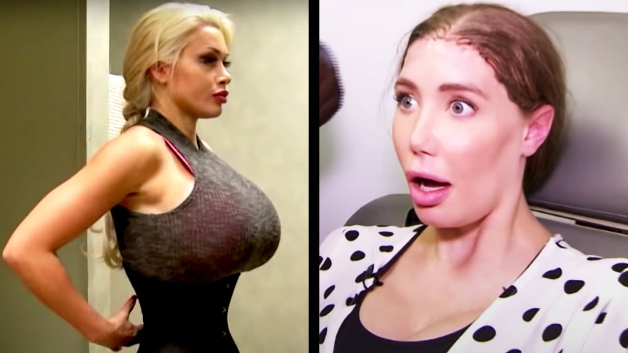 Unusual Cosmetic Procedures