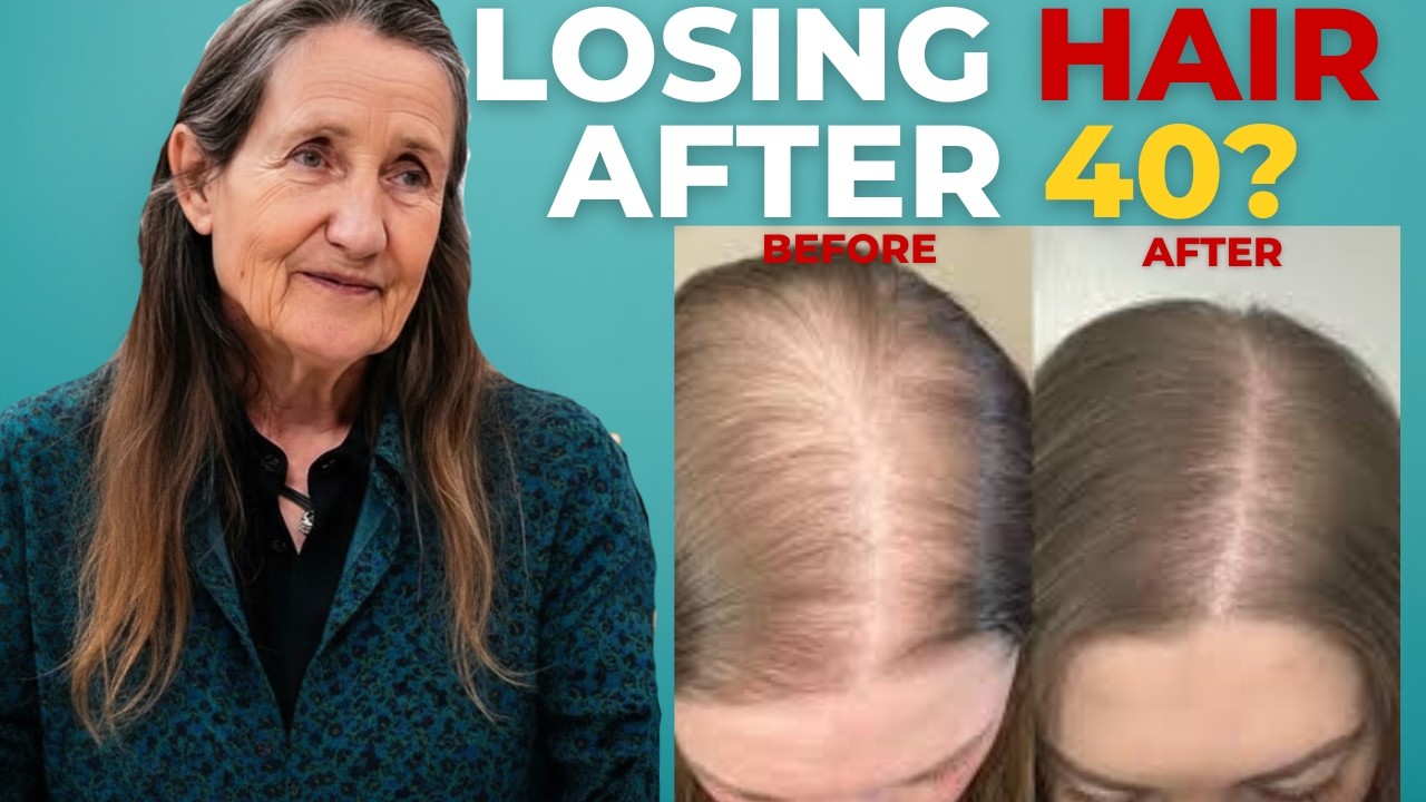 Why Women Over 40 Are Losing Their Hair -The Truth Doctors Don&rsquo;t Explain | Healthy Life with Barbara