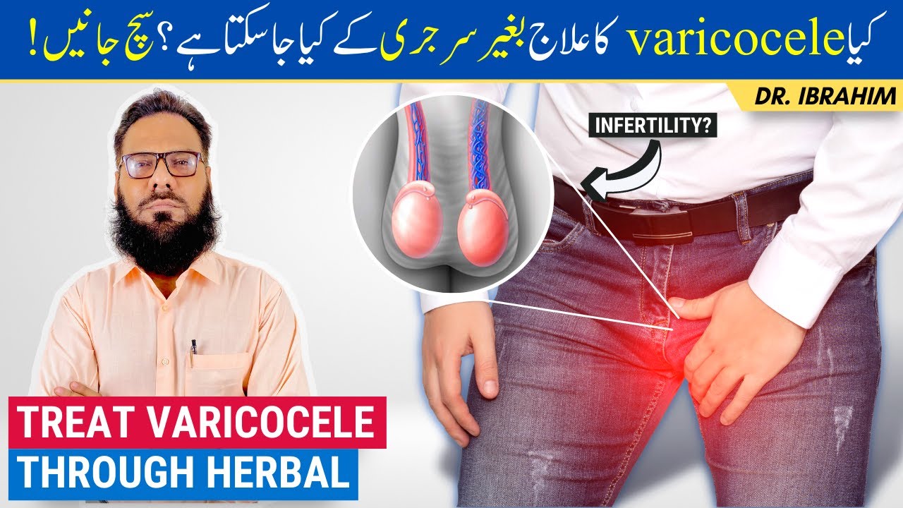 Varicocele Ka Ilaj - Treat Varicocele Naturally with Herbal Medicine - Urdu/Hindi - Dr. Ibrahim