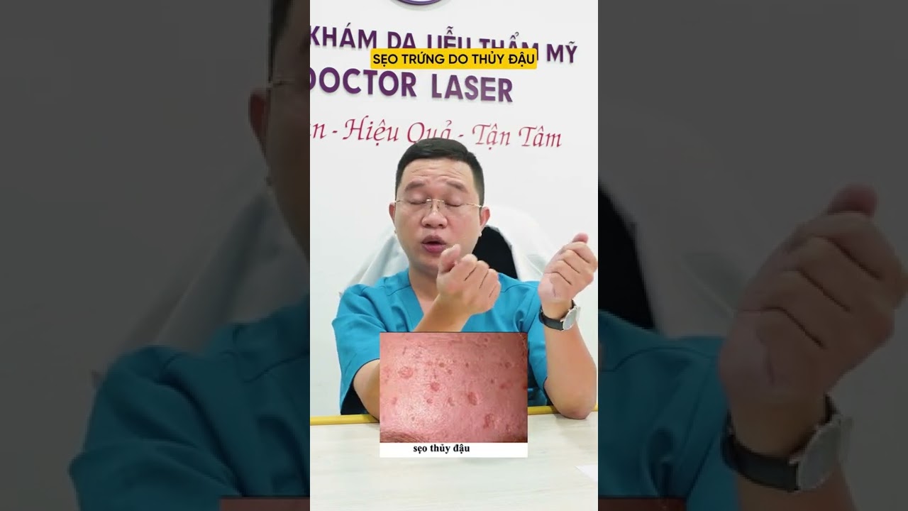 TRỊ SẸO RỖ BẰNG LĂN KIM CÓ ĐƯỢC KHÔNG| BÁC SĨ LƯƠNG