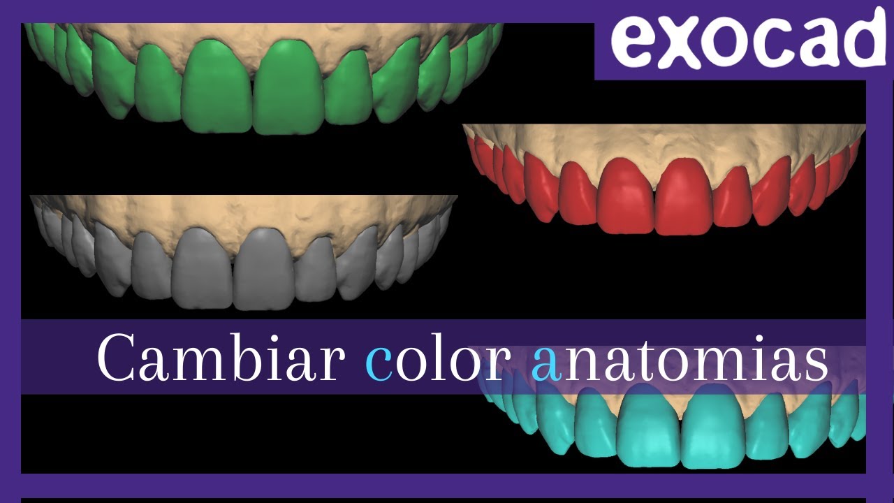 Exocad como cambiar el color de las anatomias💥