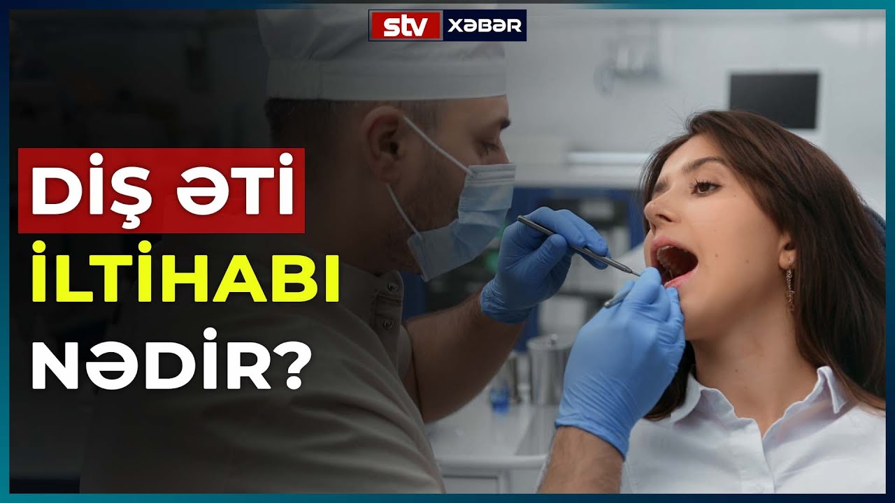 DİŞ ƏTİ İLTİHABI NƏDİR? - STV XƏBƏR
