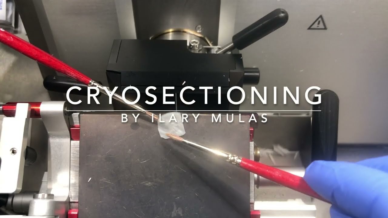 CRYOSECTIONING OCT embedded blocks of tissues
