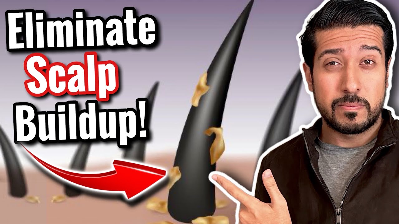 How to Eliminate Scalp Buildup in 5 Easy Steps