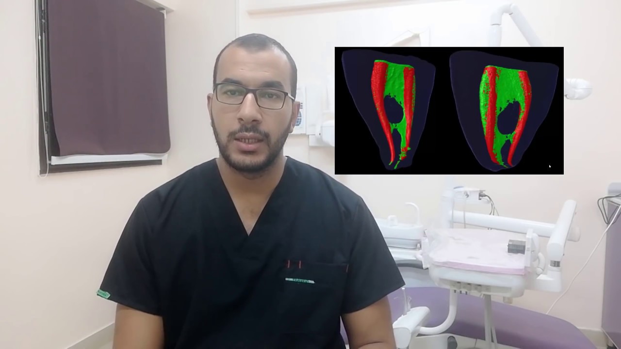 Basics of Rotary in Endodontics