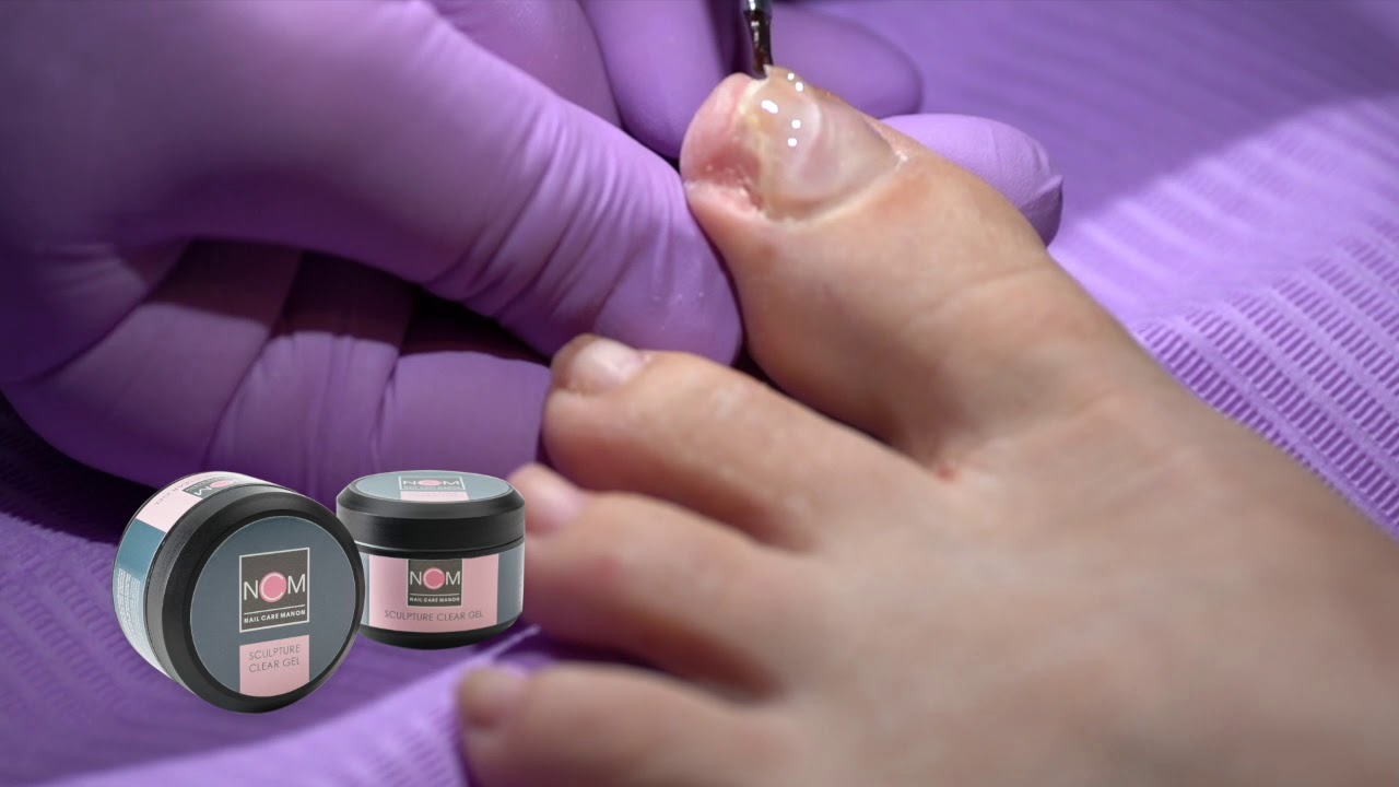 NCM Sculpture Gel Systeem