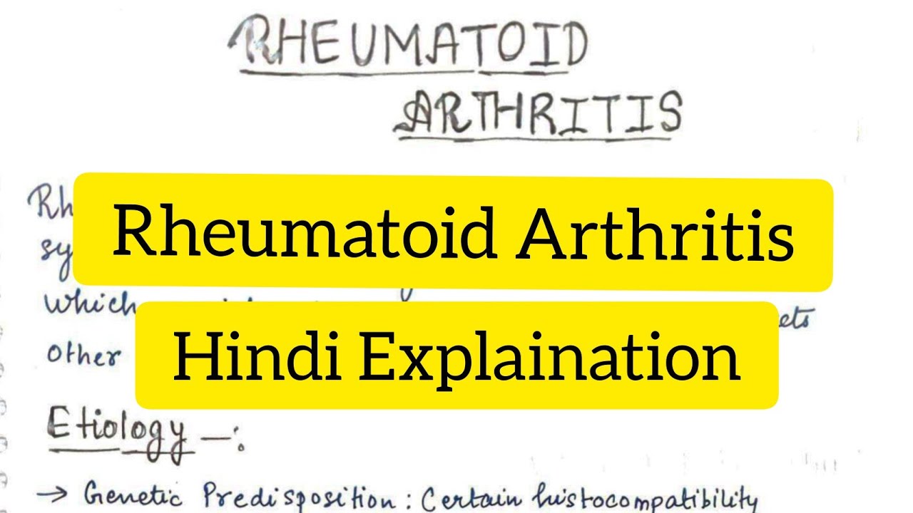 Rheumatoid Arthritis | Causes | Symptoms | Pathophysiology | Diagnosis | Management|