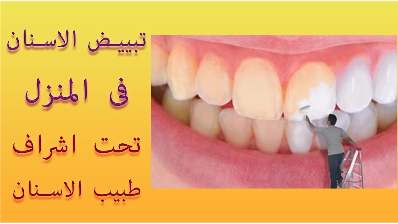 طرق امنه لتبييض الاسنان فى المنزل اسباب تؤدى لاصفرار الاسنان - وصفات الدكتور لتبييض الاسنان