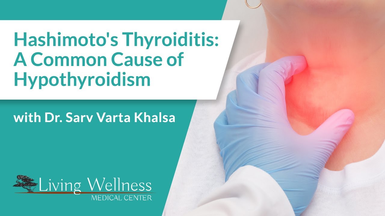 Hashimoto's Thyroiditis: A Common Cause of Hypothyroidism