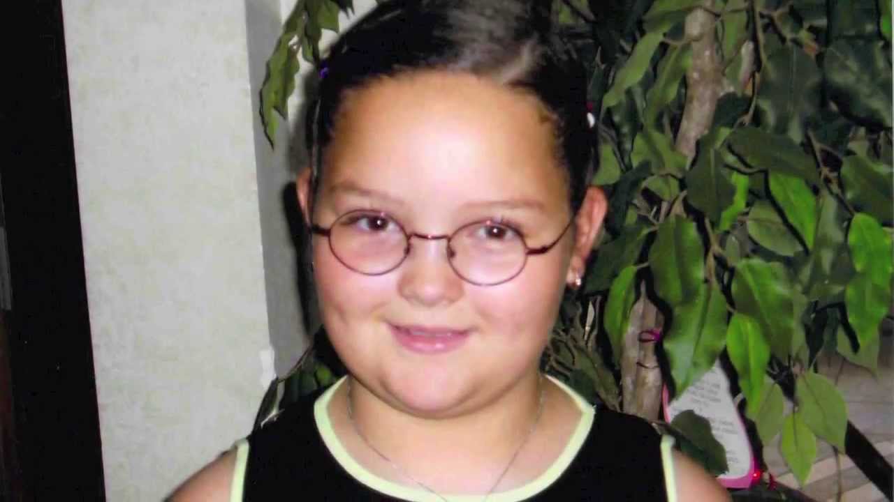 12 Year Old Gastric Sleeve Patient: Before and After Slideshow | Weight Loss Procedure